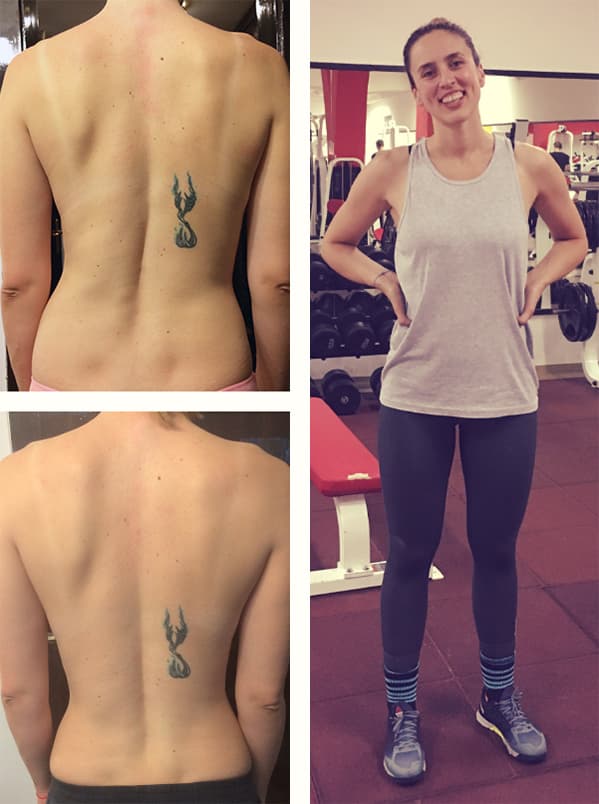 Marijana V. (33) - Head of online operations - 12 months - Premium package - Scoliosis, lumbar disc protrusion, hip pain, muscle weakness..