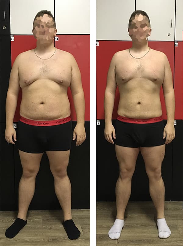 Aleksa S. (24) - Professional gamer - 3 months - Nutrition package - Obesity, insulin resistance, gastrointestinal problems, asthma..